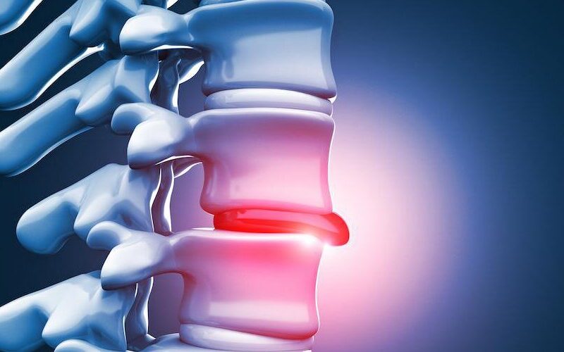 gerincfájdalom gerincfájdalom